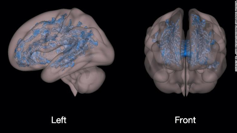 Bộ não trẻ thích xem TV, điện thoại và trẻ thích đọc sách lớn lên có sự khác biệt lớn, cha mẹ cần lưu ý- Ảnh 3. Bộ não trẻ thích xem TV, điện thoại và trẻ thích đọc sách lớn lên có sự khác biệt lớn, cha mẹ cần lưu ý- Ảnh 3.