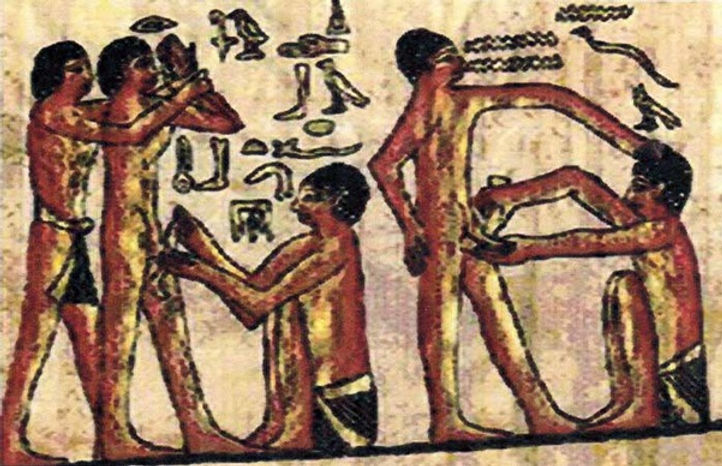 Đây là 5 công cụ tránh thai của 100 năm trước, giờ chỉ còn thấy trong viện bảo tàng- Ảnh 1. Đây là 5 công cụ tránh thai của 100 năm trước, giờ chỉ còn thấy trong viện bảo tàng- Ảnh 1.