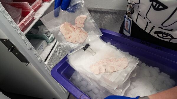 Mô não người đông lạnh 18 tháng có thể hoạt động hoàn hảo sau khi rã đông: Liệu đây có phải là sự thật?- Ảnh 3. Mô não người đông lạnh 18 tháng có thể hoạt động hoàn hảo sau khi rã đông: Liệu đây có phải là sự thật?- Ảnh 3.