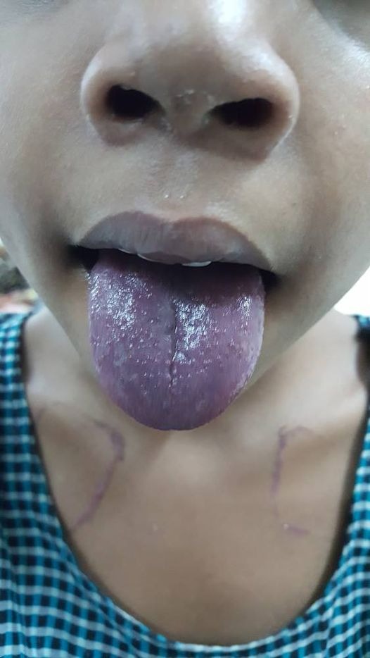 Cỗ máy có thể nhìn lưỡi đoán bệnh chính xác tới 98%: 1.500 năm phát triển của Đông y được gói vào trong một thuật toán AI duy nhất- Ảnh 7. Cỗ máy có thể nhìn lưỡi đoán bệnh chính xác tới 98%: 1.500 năm phát triển của Đông y được gói vào trong một thuật toán AI duy nhất- Ảnh 7.