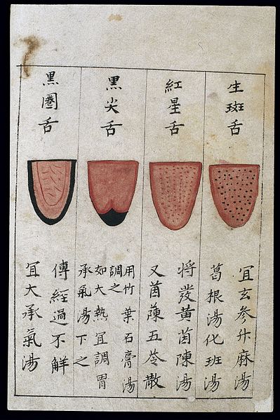 Cỗ máy có thể nhìn lưỡi đoán bệnh chính xác tới 98%: 1.500 năm phát triển của Đông y được gói vào trong một thuật toán AI duy nhất- Ảnh 1. Cỗ máy có thể nhìn lưỡi đoán bệnh chính xác tới 98%: 1.500 năm phát triển của Đông y được gói vào trong một thuật toán AI duy nhất- Ảnh 1.