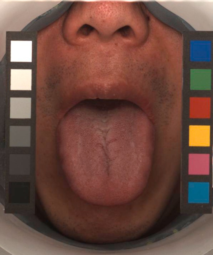 Cỗ máy có thể nhìn lưỡi đoán bệnh chính xác tới 98%: 1.500 năm phát triển của Đông y được gói vào trong một thuật toán AI duy nhất- Ảnh 11. Cỗ máy có thể nhìn lưỡi đoán bệnh chính xác tới 98%: 1.500 năm phát triển của Đông y được gói vào trong một thuật toán AI duy nhất- Ảnh 11.