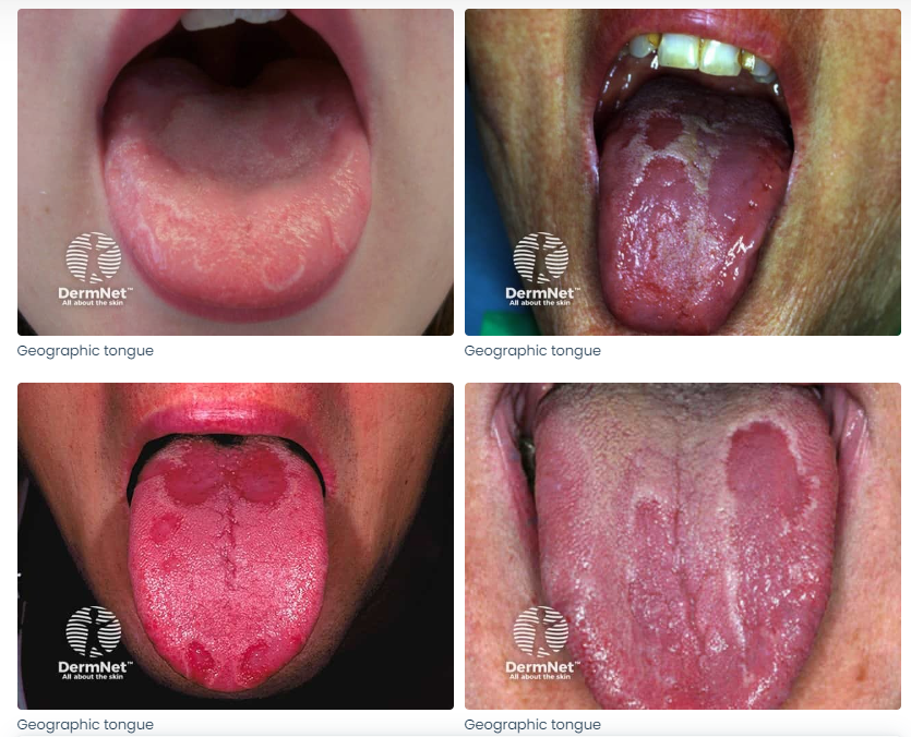 Cỗ máy có thể nhìn lưỡi đoán bệnh chính xác tới 98%: 1.500 năm phát triển của Đông y được gói vào trong một thuật toán AI duy nhất- Ảnh 8. Cỗ máy có thể nhìn lưỡi đoán bệnh chính xác tới 98%: 1.500 năm phát triển của Đông y được gói vào trong một thuật toán AI duy nhất- Ảnh 8.