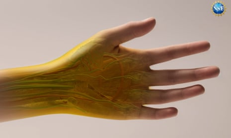 Thuốc nhuộm thực phẩm biến 'da thịt' thành trong suốt- Ảnh 1. Thuốc nhuộm thực phẩm biến 'da thịt' thành trong suốt- Ảnh 1.