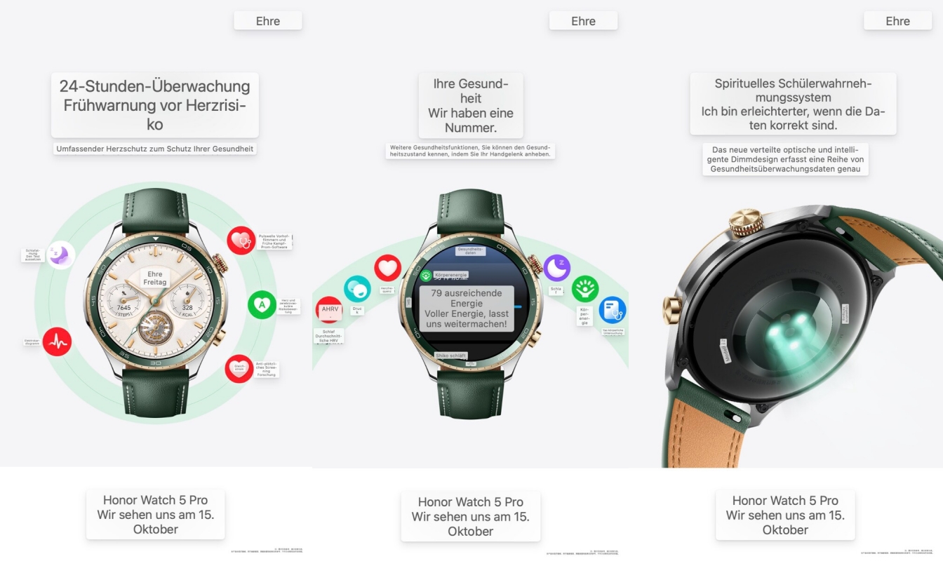 Lộ ảnh thật Honor Watch 5 Pro: Đo huyết áp, ECG, pin nửa tháng, có eSIM, giá dự kiến khoảng 5 - 6 triệu- Ảnh 3. Lộ ảnh thật Honor Watch 5 Pro: Đo huyết áp, ECG, pin nửa tháng, có eSIM, giá dự kiến khoảng 5 - 6 triệu- Ảnh 3.