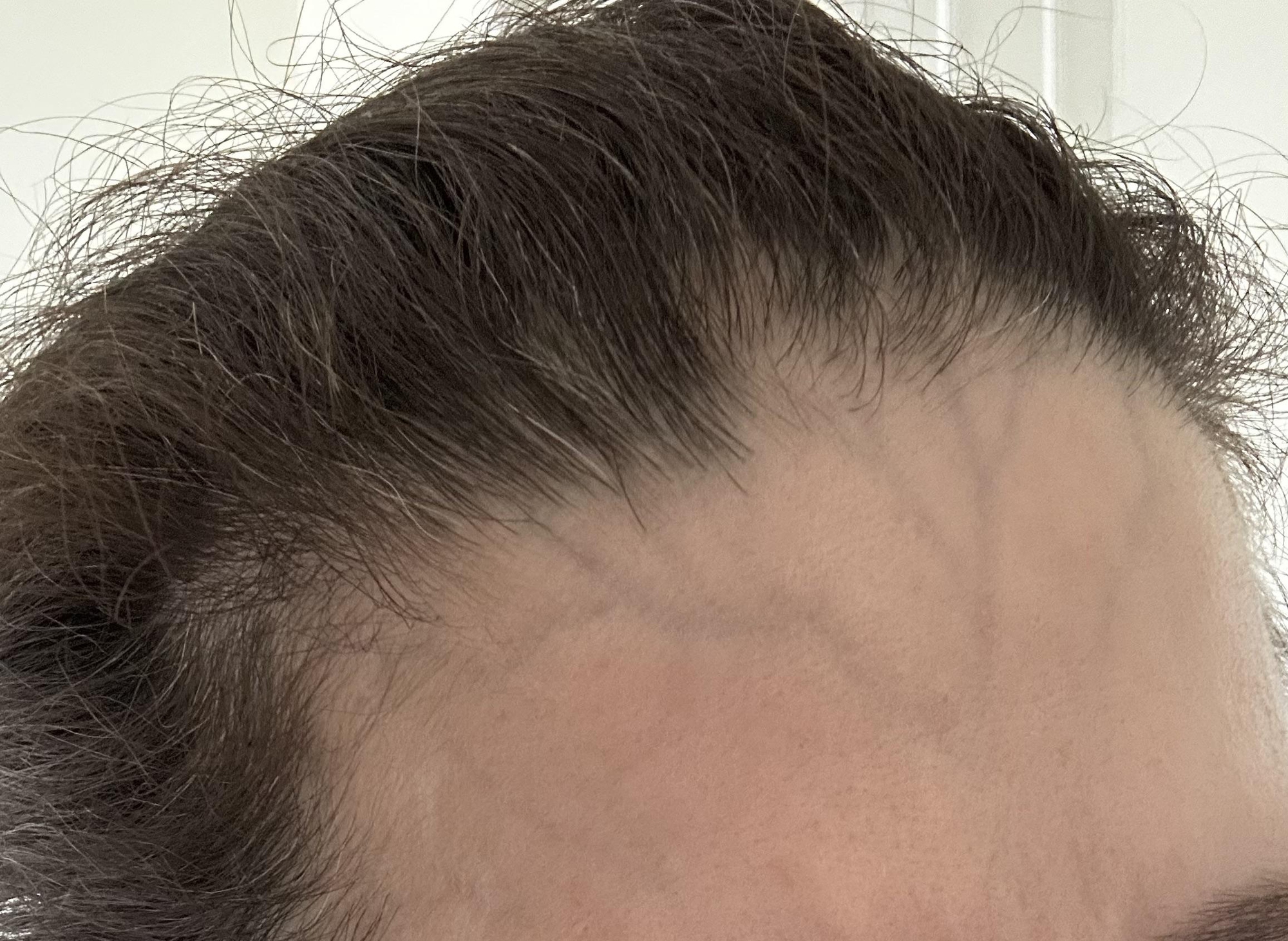 Nổi nhiều g&acirc;n tay l&agrave; khỏe hay yếu? Thấy g&acirc;n xanh nổi r&otilde; ở 6 nơi n&agrave;y tr&ecirc;n cơ thể tức trong người đầy bệnh- Ảnh 3.