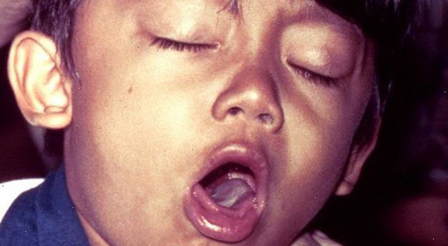 Vi khuẩn ho g&agrave; đ&atilde; kh&aacute;ng vắc-xin, ch&uacute;ng ta sẽ cần một vắc-xin mới trong thập kỷ tới - Ảnh 1.