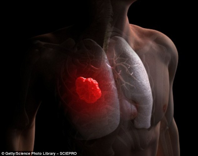 Các sai hỏng trong DNA là nguyên nhân gây ra ung thư phổi