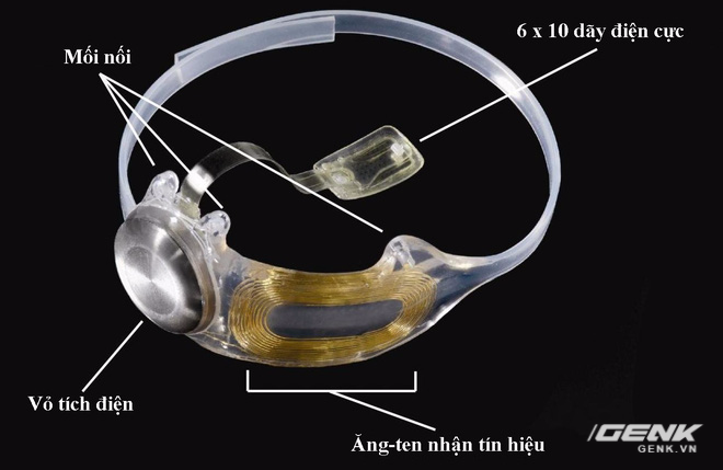 Chiếc mắt điện tử này sẽ nằm trong mắt người bệnh, không khác gì những linh kiện nâng cấp cho cyborg nửa người nửa máy trong phim và game viễn tưởng.