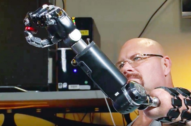 Cánh tay robot điều khiển bằng suy nghĩ tiên tiến nhất hiện nay