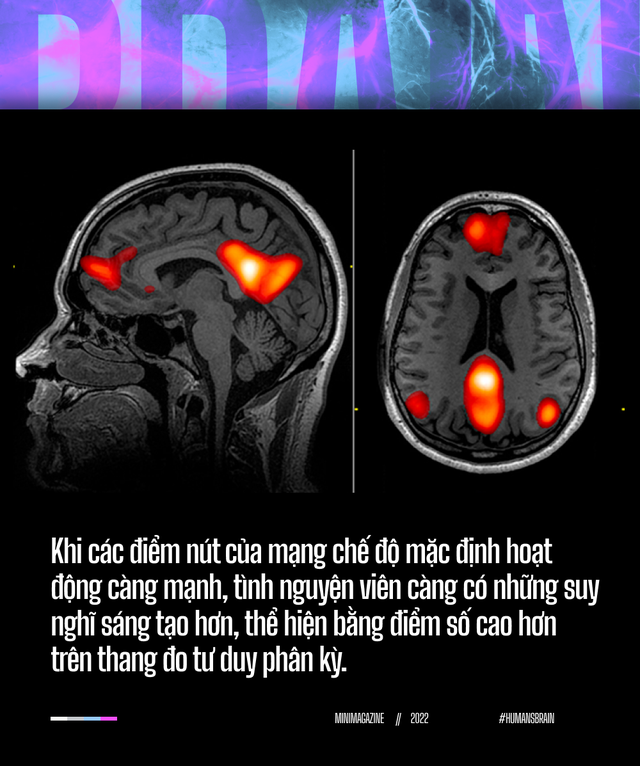 Đi t&igrave;m suối nguồn s&aacute;ng tạo trong n&atilde;o bộ: Tại sao những &yacute; tưởng đột ph&aacute; lu&ocirc;n xuất hiện khi ch&uacute;ng ta đang tắm? - Ảnh 12.