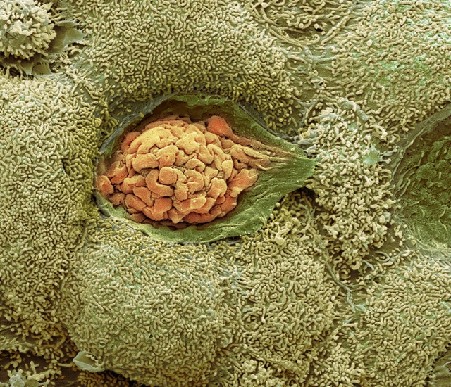 Có một vũ trụ ẩn bên trong cơ thể chúng ta, và đây là minh chứng - Ảnh 8. Có một vũ trụ ẩn bên trong cơ thể chúng ta, và đây là minh chứng - Ảnh 8.