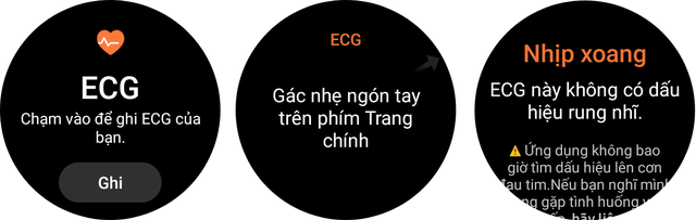 Điện t&acirc;m đồ, huyết &aacute;p - Ảnh 5.
