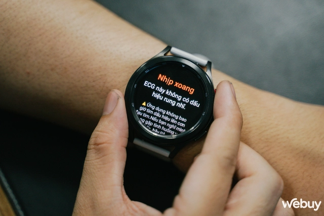 Điện tâm đồ, huyết áp - Ảnh 4. Điện tâm đồ, huyết áp - Ảnh 4.