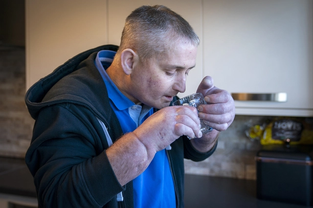 30 bác sĩ phẫu thuật trong 12 tiếng giúp người đàn ông ghép đôi bàn tay mới - Ảnh 7. 30 bác sĩ phẫu thuật trong 12 tiếng giúp người đàn ông ghép đôi bàn tay mới - Ảnh 7.