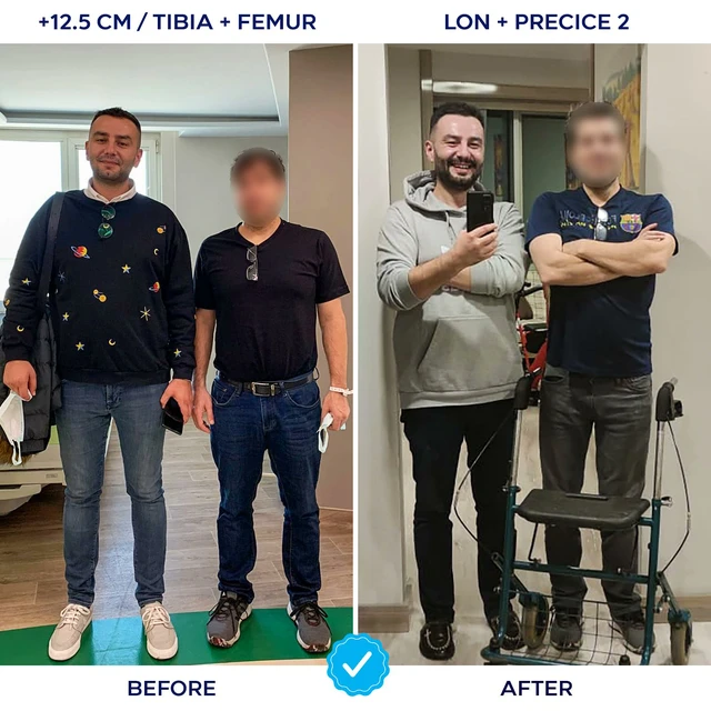 Khoa Pug chi 2 tỷ k&eacute;o d&agrave;i ch&acirc;n l&ecirc;n 1m8: Đ&acirc;y l&agrave; chi tiết về ca phẫu thuật anh ấy sẽ thực hiện - Ảnh 16.