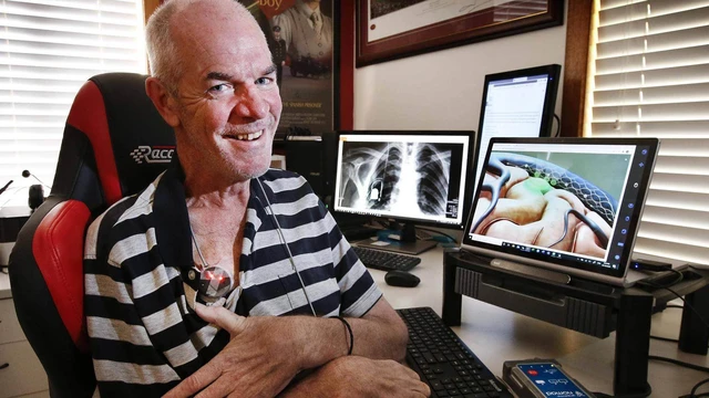 Kh&ocirc;ng phải Neuralink của Elon Musk, đ&acirc;y mới l&agrave; c&ocirc;ng ty dẫn đầu thế giới về c&ocirc;ng nghệ cấy chip v&agrave;o n&atilde;o người - Ảnh 10.