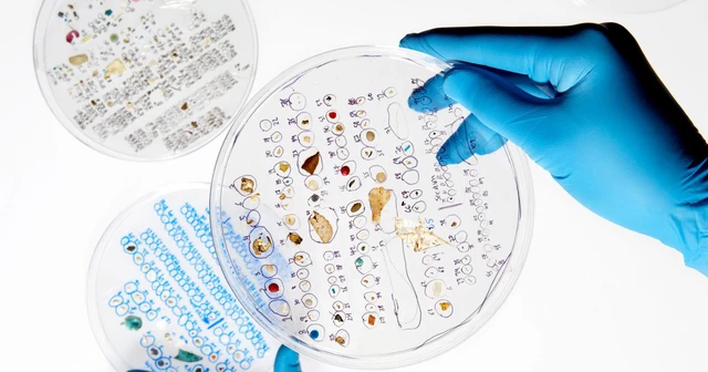 Nghiên cứu tìm thấy hạt vi nhựa trong gạo: Bạn nên hay không nên vo gạo trước khi nấu? - Ảnh 7. Nghiên cứu tìm thấy hạt vi nhựa trong gạo: Bạn nên hay không nên vo gạo trước khi nấu? - Ảnh 7.