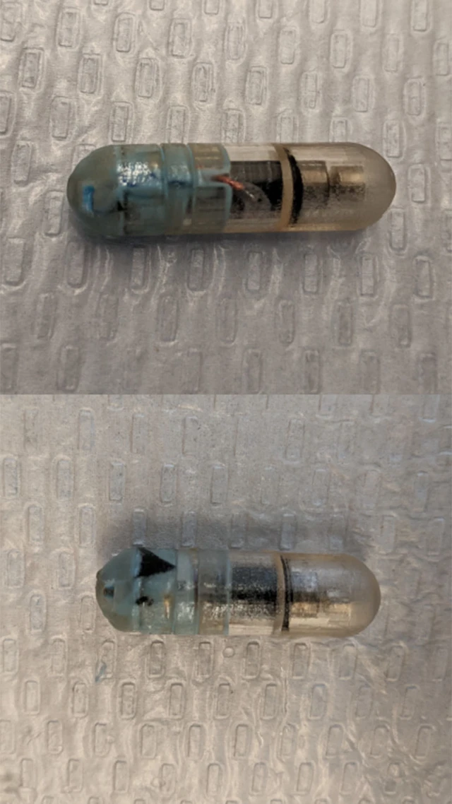 Khoa học hé lộ phương pháp giảm cân mới: Viên nang chạy điện tạo cảm giác no cho dạ dày- Ảnh 3. Khoa học hé lộ phương pháp giảm cân mới: Viên nang chạy điện tạo cảm giác no cho dạ dày- Ảnh 3.