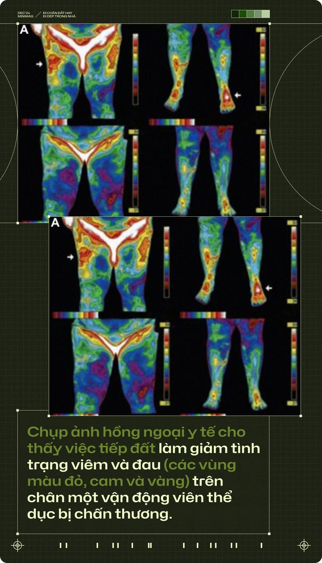 20 năm trôi qua, tôi chẳng còn thấy ai đi chân đất trong nhà, còn những đôi dép nhựa thì xâm chiếm cả thế giới- Ảnh 16. 20 năm trôi qua, tôi chẳng còn thấy ai đi chân đất trong nhà, còn những đôi dép nhựa thì xâm chiếm cả thế giới- Ảnh 16.