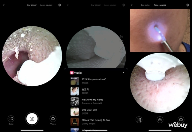 Dùng thử ngoáy tai gắn camera Xiaomi Bebird R1: Rẻ mà "ngon", dùng tiện, ngoáy sạch, kèm cả nhạc du dương- Ảnh 7. Dùng thử ngoáy tai gắn camera Xiaomi Bebird R1: Rẻ mà "ngon", dùng tiện, ngoáy sạch, kèm cả nhạc du dương- Ảnh 7.