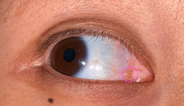 Tại sao rất nhiều loài động vật có mí mắt thứ ba, bao gồm cả thú cưng của chúng ta, nhưng con người thì không?- Ảnh 5. Tại sao rất nhiều loài động vật có mí mắt thứ ba, bao gồm cả thú cưng của chúng ta, nhưng con người thì không?- Ảnh 5.