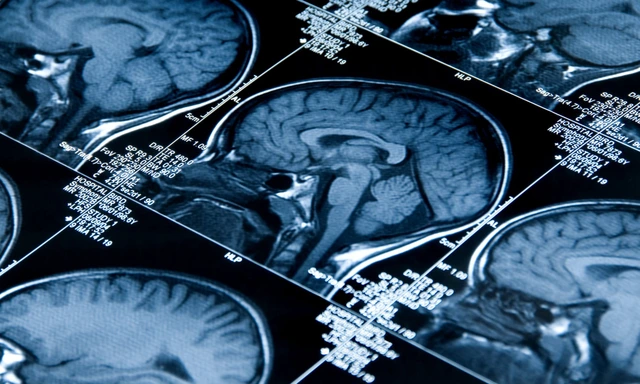 Nghi&ecirc;n cứu g&acirc;y tranh c&atilde;i cho thấy &ldquo;hội c&uacute; đ&ecirc;m&rdquo; sở hữu chức năng nhận thức cao hơn người dậy sớm- Ảnh 2.