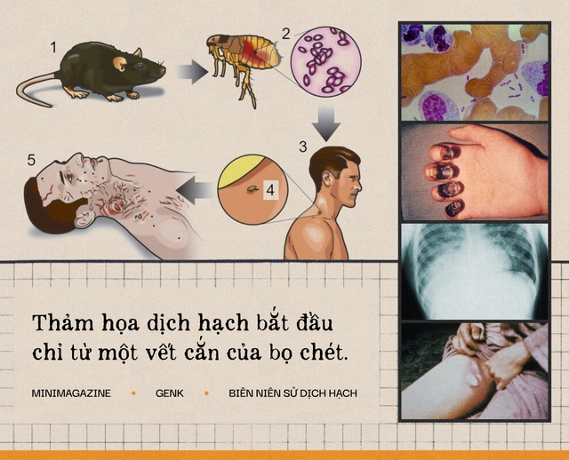 Một biên niên sử về dịch hạch tại Việt Nam và "Cái chết đen" từng xóa sổ 50% dân số Châu Âu trong quá khứ- Ảnh 9. Một biên niên sử về dịch hạch tại Việt Nam và "Cái chết đen" từng xóa sổ 50% dân số Châu Âu trong quá khứ- Ảnh 9.