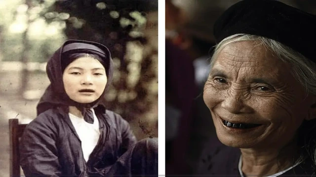 Phát hiện chấn động tại di chỉ Đông Xá: Tục nhuộm răng đen của người Việt đã tồn tại từ 2.000 năm trước - Ảnh 2.