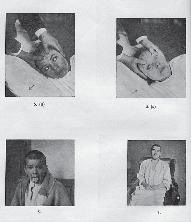 Bí ẩn về căn bệnh cướp đi 500.000 sinh mạng rồi đột ngột biến mất không một dấu vết - Ảnh 2.