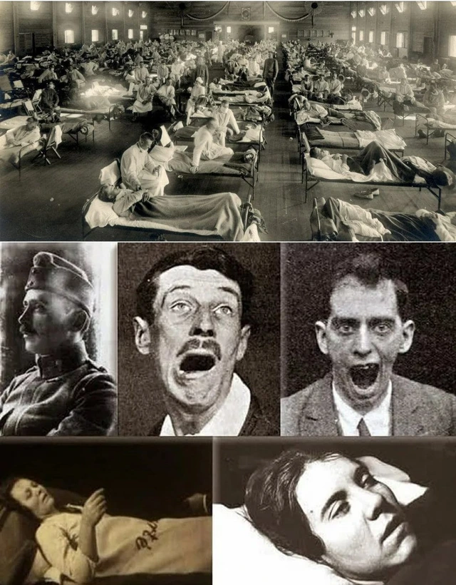 Bí ẩn về căn bệnh cướp đi 500.000 sinh mạng rồi đột ngột biến mất không một dấu vết - Ảnh 1.