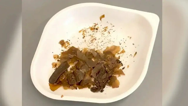 Có thể bạn chưa biết, vào thời La Mã người ta đã sử dụng phân người làm thuốc - Ảnh 2.