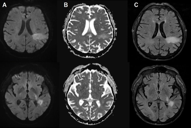 Rất có thể bạn đã bị nhiễm một loại virus ăn não mà bạn chưa từng nghe đến - Ảnh 2.
