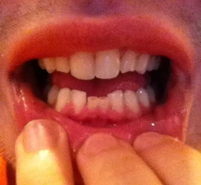 Những trường hợp biến đổi cơ thể kỳ lạ được chia sẻ tr&ecirc;n mạng Internet - Ảnh 7.