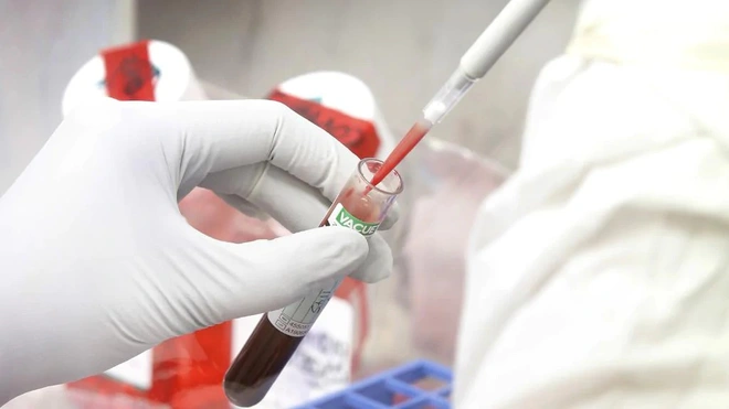 Lần đầu ti&ecirc;n c&aacute;c nh&agrave; khoa học lập được bản đồ miễn dịch của bệnh nh&acirc;n Covid-19, rất nhiều b&iacute; ẩn sẽ được giải đ&aacute;p - Ảnh 2.