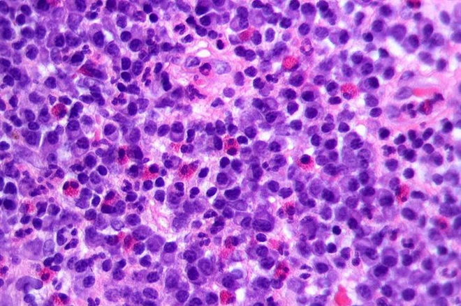 Giải ngố: Tập thể dục c&oacute; tạm thời l&agrave;m suy yếu hệ miễn dịch của bạn hay kh&ocirc;ng? - Ảnh 2.