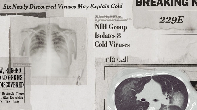 Lịch sử b&iacute; ẩn của họ virus corona: Từ cơn cảm lạnh th&ocirc;ng thường đến những đại dịch to&agrave;n cầu - Ảnh 1.