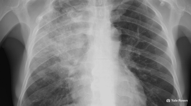 C&aacute;c chuy&ecirc;n gia y khoa kh&ocirc;ng tin v&agrave;o khả năng qu&eacute;t bản chụp X-quang để ph&aacute;t hiện virus corona của AI - Ảnh 1.