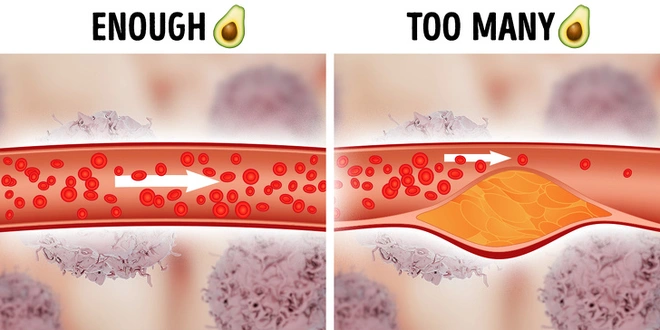 Tại sao kh&ocirc;ng n&ecirc;n ăn qu&aacute; nhiều c&agrave; rốt? Khoa học l&yacute; giải c&aacute;c th&oacute;i quen ăn uống xấu m&agrave; mọi người vẫn nghĩ l&agrave; l&agrave;nh mạnh - Ảnh 4.