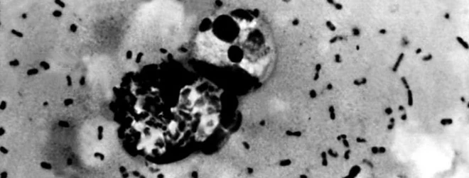 Trung Quốc vừa ph&aacute;t hiện một ca dịch hạch dẫn đến cảnh b&aacute;o cấp độ 3, điều đ&oacute; nghĩa l&agrave; g&igrave;? - Ảnh 3.