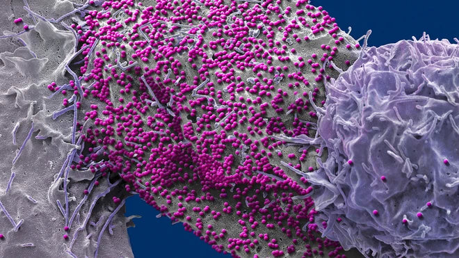 Bệnh nh&acirc;n HIV đầu ti&ecirc;n tr&ecirc;n thế giới khỏi bệnh chỉ nhờ uống thuốc theo chiến lược th&ocirc;ng minh? - Ảnh 1.