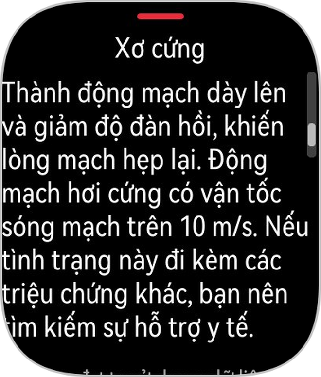 Tôi dùng đồng hồ mới lần đầu tiên ra mắt của Huawei: Quá thực dụng!- Ảnh 22. Tôi dùng đồng hồ mới lần đầu tiên ra mắt của Huawei: Quá thực dụng!- Ảnh 22.