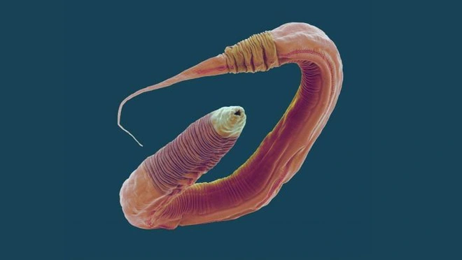 Chỉnh sửa gen gi&uacute;p c&aacute;c nh&agrave; khoa học tăng 500% tuổi thọ của giun, tương đương 400 năm ở con người - Ảnh 1.