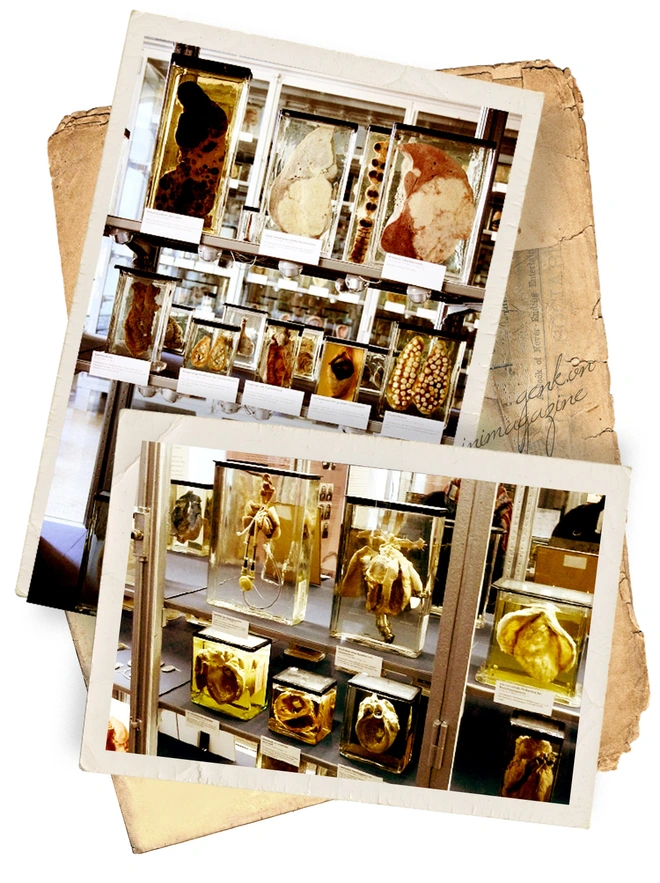 Căn hầm chứa đầy những l&aacute; phổi ở Berlin v&agrave; chiếc k&iacute;nh viễn vọng nh&igrave;n v&agrave;o qu&aacute; khứ - Ảnh 2.