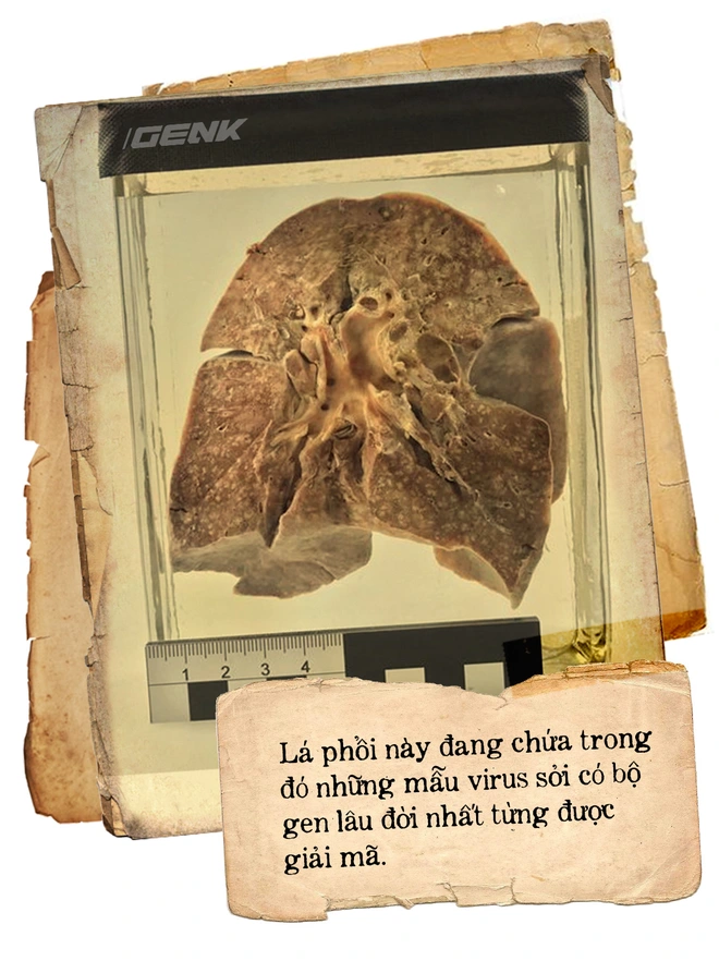 Căn hầm chứa đầy những l&aacute; phổi ở Berlin v&agrave; chiếc k&iacute;nh viễn vọng nh&igrave;n v&agrave;o qu&aacute; khứ - Ảnh 4.