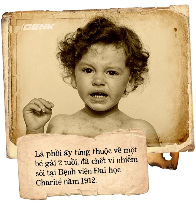 Căn hầm chứa đầy những l&aacute; phổi ở Berlin v&agrave; chiếc k&iacute;nh viễn vọng nh&igrave;n v&agrave;o qu&aacute; khứ - Ảnh 5.