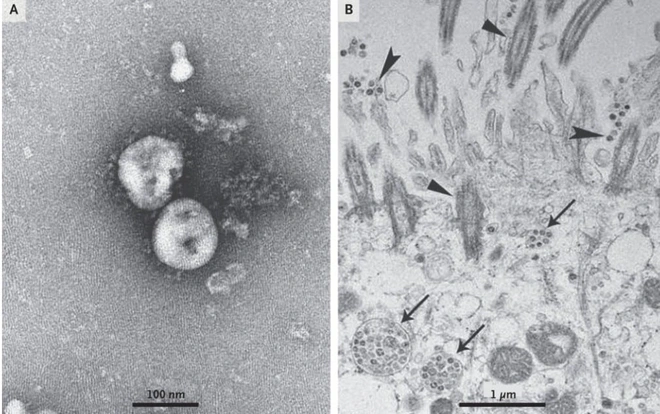 Bạn đang sốt hoặc ho: Hiện chỉ c&oacute; một loại x&eacute;t nghiệm duy nhất gi&uacute;p x&aacute;c định đ&oacute; c&oacute; phải do virus corona hay kh&ocirc;ng - Ảnh 3.