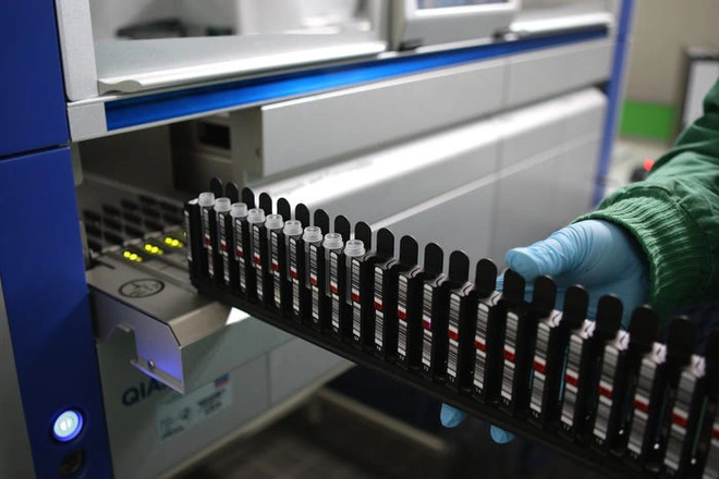 Bạn đang sốt hoặc ho: Hiện chỉ c&oacute; một loại x&eacute;t nghiệm duy nhất gi&uacute;p x&aacute;c định đ&oacute; c&oacute; phải do virus corona hay kh&ocirc;ng - Ảnh 7.