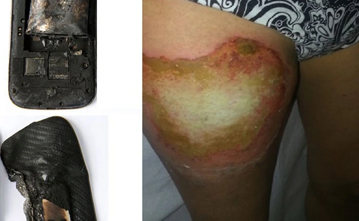 Hiểm hoạ khôn lường khi dùng pin smartphone, laptop "rởm"