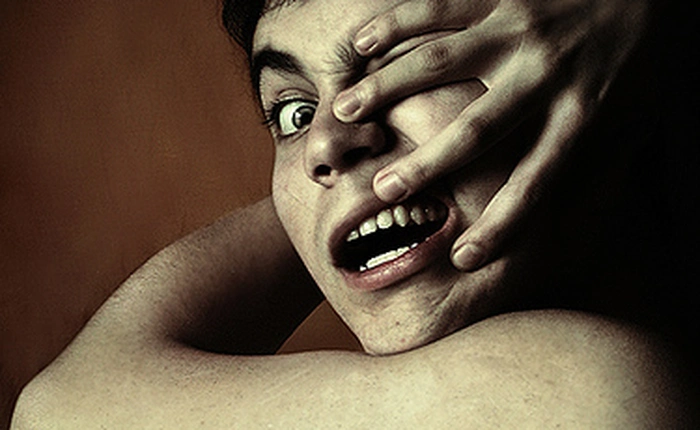 Kì lạ hội chứng "bàn tay ngoài hành tinh"